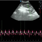 Pregnancy Diagnosis in canine